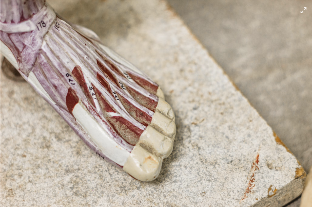 Recuperarea dupa ruptura de ligament incrucisat anterior (LIA) - tot ce trebuie sa stii