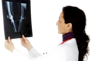Osteoporoza: pericolul ascuns
