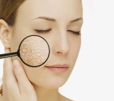 5 remedii naturale pentru hidratarea pielii uscate