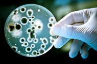 Microbii - intre adevar si mit