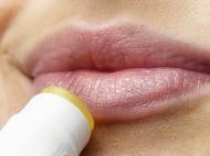 Ai herpes? Iata cum poti scapa rapid si eficient de aceasta problema!