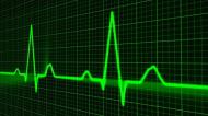 10 mituri legate de bolile cardiovasculare