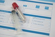 Testari gratuite pentru depistarea infectiei cu HIV si cu virusurile hepatice B si C