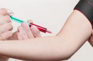 5 simptome timpurii ale diabetului: fii atent la aceste semne!